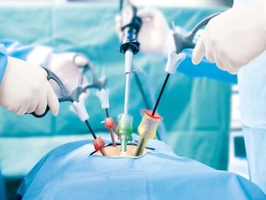 Laparoscopy Surgery   KNOW MORE