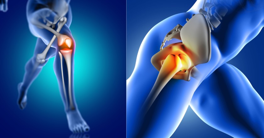 this image showen Hip and knee replacement surgery